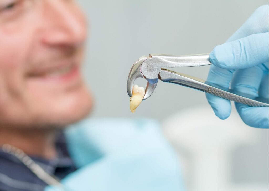 Dentist holding a recently extracted wisdom tooth, illustrating a case where wisdom tooth extraction is necessary due to pain or complications.